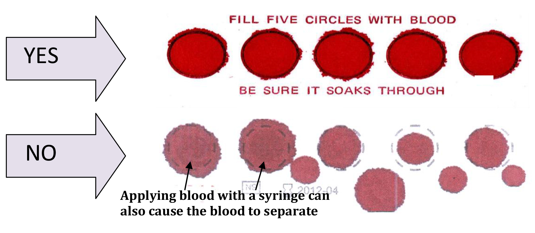 an illustration showing the the correct and incorrect ways the five circles should be filled with blood